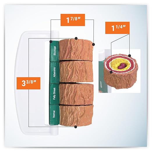 GPI Anatomicals - 4-Piece Artery Model, Replica of an Artery with Plaque for Human Anatomy and Physiology Education, Anatomy Model for Doctor's Offices and Classrooms, Medical Learning Resources