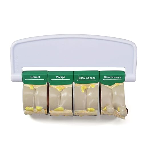 GPI Anatomicals - 4-Piece Colon Model, Replica of a Colon with Pathologies for Human Anatomy and Physiology Education, Anatomy Model for Doctor's Offices and Classrooms, Medical Learning Resources