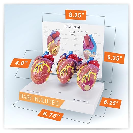 GPI Anatomicals - 3-Piece Mini Heart Model Set, Normal and Diseased Heart Models for Anatomy and Physiology Education, Anatomy Model for Doctor's Office and Classrooms, Medical Learning Resources