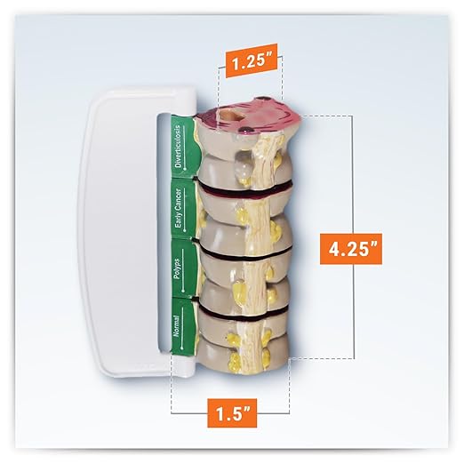GPI Anatomicals - 4-Piece Colon Model, Replica of a Colon with Pathologies for Human Anatomy and Physiology Education, Anatomy Model for Doctor's Offices and Classrooms, Medical Learning Resources