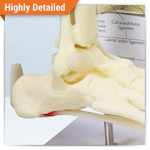 GPI Anatomicals - Foot and Ankle Model, Replica of Foot and Ankle with Plantar Fasciitis for Human Anatomy and Physiology Education, Anatomy Model for Doctor's Office, Medical Learning Resources
