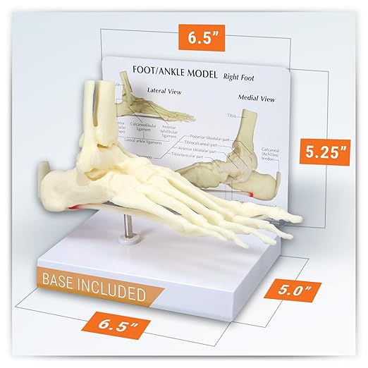 GPI Anatomicals - Foot and Ankle Model, Replica of Foot and Ankle with Plantar Fasciitis for Human Anatomy and Physiology Education, Anatomy Model for Doctor's Office, Medical Learning Resources