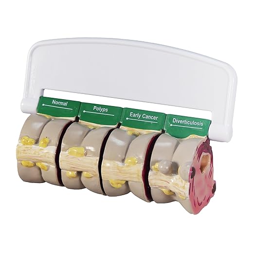 GPI Anatomicals - 4-Piece Colon Model, Replica of a Colon with Pathologies for Human Anatomy and Physiology Education, Anatomy Model for Doctor's Offices and Classrooms, Medical Learning Resources