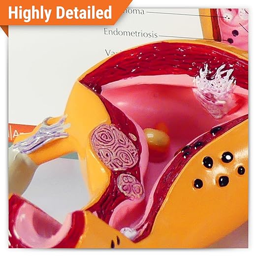 GPI Anatomicals - Uterus and Ovary Model, Model of Female Reproductive System for Human Anatomy and Physiology Education, Anatomy Model for Doctor's Office and Classrooms, Medical Learning Resources
