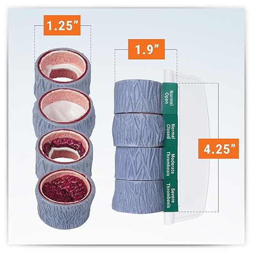GPI Anatomicals - 4-Piece Vein Model, Replica of a Vein with Blood Clot for Human Anatomy and Physiology Education, Anatomy Model for Doctor's Offices and Classrooms, Medical Learning Resources