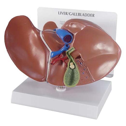 GPI Anatomicals - Liver and Gallbladder Model, Replica of Digestive System with Gallstones for Human Anatomy and Physiology Education, Anatomy Model for Doctor's Office, Medical Learning Resources