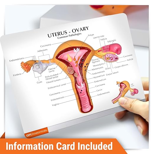 GPI Anatomicals - Uterus and Ovary Model, Model of Female Reproductive System for Human Anatomy and Physiology Education, Anatomy Model for Doctor's Office and Classrooms, Medical Learning Resources