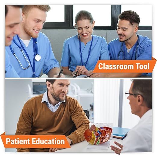 GPI Anatomicals - Liver Model with Common Pathologies, Replica for Human Anatomy and Physiology Education, Anatomy Model for Doctor's Offices and Classrooms, Medical Learning Resources