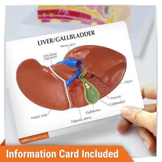 GPI Anatomicals - Liver and Gallbladder Model, Replica of Digestive System with Gallstones for Human Anatomy and Physiology Education, Anatomy Model for Doctor's Office, Medical Learning Resources