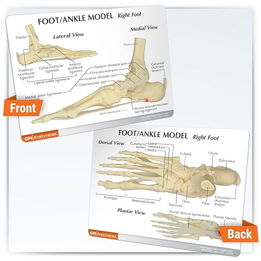 GPI Anatomicals - Foot and Ankle Model, Replica of Foot and Ankle with Plantar Fasciitis for Human Anatomy and Physiology Education, Anatomy Model for Doctor's Office, Medical Learning Resources