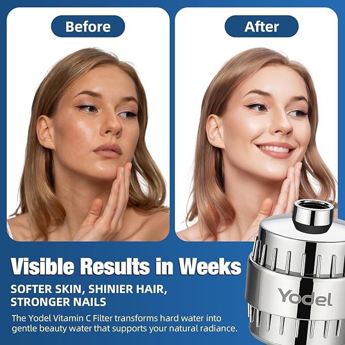 Yodel Shower Filter for Hard Water - 25 Stage Shower Head Filter Removes Chlorine for Hair and Skin, Reduces Dry Skin, Dandruff and Hair Damage, Universal High Output Water Filter,Chrome