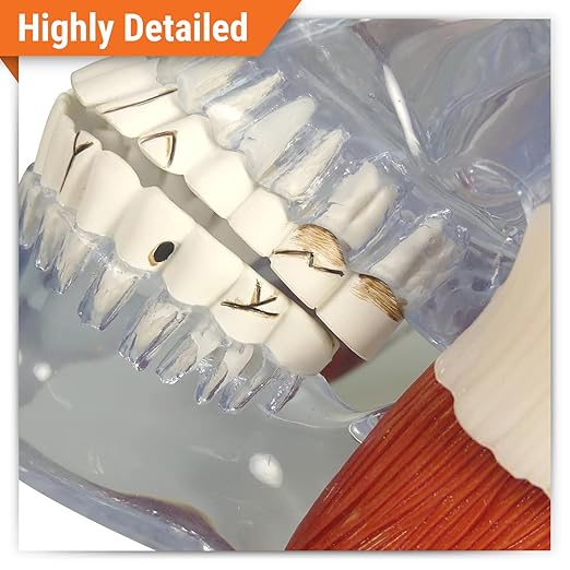 GPI Anatomicals - Temporomandibular Joint (TMJ) Model, Replica with Pathologies for Human Anatomy and Physiology Education, Anatomy Model for Doctor's Offices and Classrooms, Medical Study Supplies