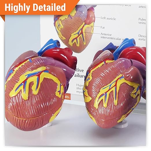 GPI Anatomicals - 3-Piece Mini Heart Model Set, Normal and Diseased Heart Models for Anatomy and Physiology Education, Anatomy Model for Doctor's Office and Classrooms, Medical Learning Resources