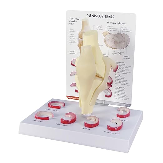 GPI Anatomicals - Human Anatomy Model of Knee Joint with Meniscus Tears, Replica for Anatomy and Physiology Education, Anatomy Model for Doctor's Office and Classrooms, Medical Learning Resources