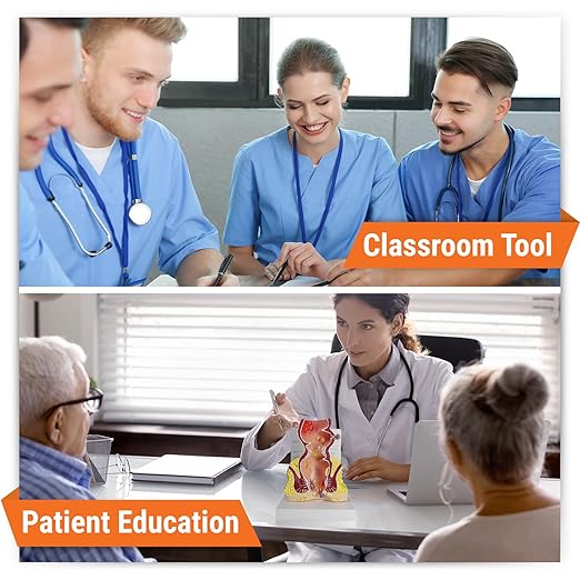 GPI Anatomicals - Human Rectum Model with Common Pathologies, Replica for Anatomy and Physiology Education, Anatomy Model for Doctor's Offices and Classrooms, Medical Learning Resources
