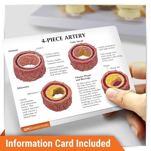 GPI Anatomicals - 4-Piece Artery Model, Replica of an Artery with Plaque for Human Anatomy and Physiology Education, Anatomy Model for Doctor's Offices and Classrooms, Medical Learning Resources