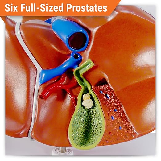 GPI Anatomicals - Liver and Gallbladder Model, Replica of Digestive System with Gallstones for Human Anatomy and Physiology Education, Anatomy Model for Doctor's Office, Medical Learning Resources