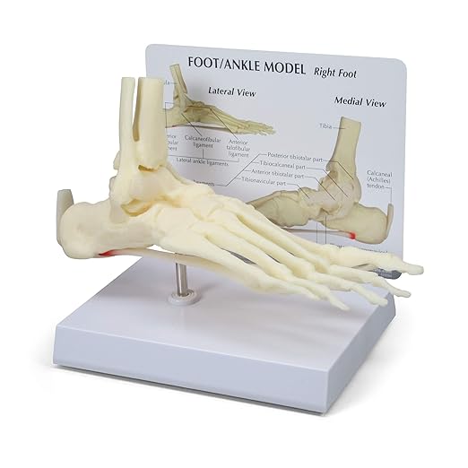 GPI Anatomicals - Foot and Ankle Model, Replica of Foot and Ankle with Plantar Fasciitis for Human Anatomy and Physiology Education, Anatomy Model for Doctor's Office, Medical Learning Resources