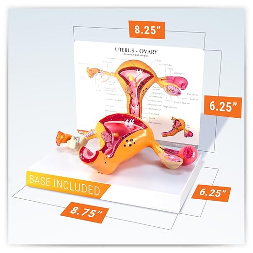 GPI Anatomicals - Uterus and Ovary Model, Model of Female Reproductive System for Human Anatomy and Physiology Education, Anatomy Model for Doctor's Office and Classrooms, Medical Learning Resources