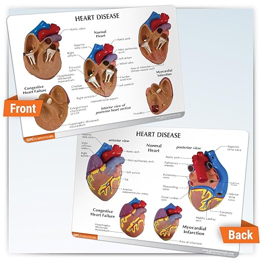 GPI Anatomicals - 3-Piece Mini Heart Model Set, Normal and Diseased Heart Models for Anatomy and Physiology Education, Anatomy Model for Doctor's Office and Classrooms, Medical Learning Resources