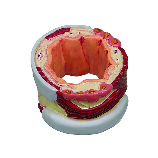 GPI Anatomicals - 4-Piece Bronchus Model, Replica of a Bronchus with Pathologies for Human Anatomy, Physiology Education, Anatomy Model for Doctor's Offices and Classrooms, Medical Learning Resources