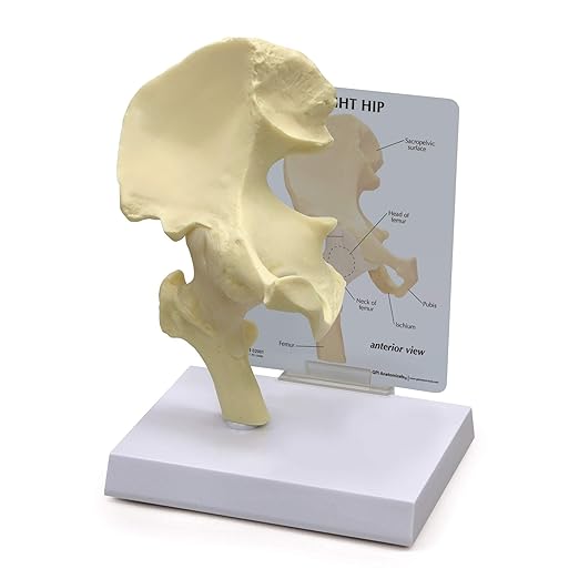 GPI Anatomicals - Basic Hip Model, Right Hip Joint Replica for Human Anatomy and Physiology Education, Anatomy Model for Doctor's Offices and Classrooms, Medical Learning Resources