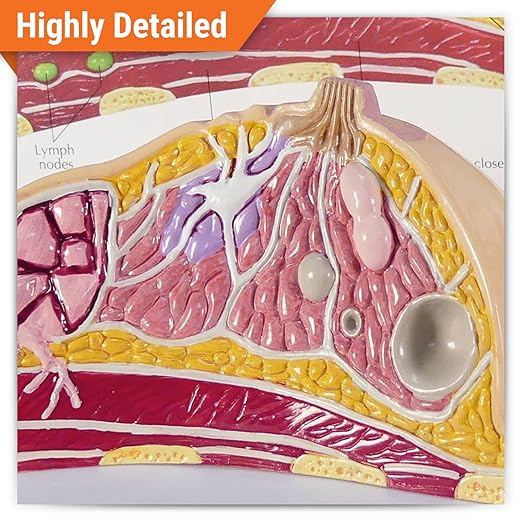 GPI Anatomicals - Breast Cross-Section Model, Replica Showing Common Pathologies for Human Anatomy, Physiology Education, Anatomy Model for Doctor's Offices and Classrooms, Medical Learning Resources