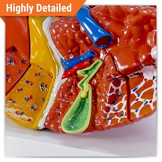 GPI Anatomicals - Liver Model with Common Pathologies, Replica for Human Anatomy and Physiology Education, Anatomy Model for Doctor's Offices and Classrooms, Medical Learning Resources