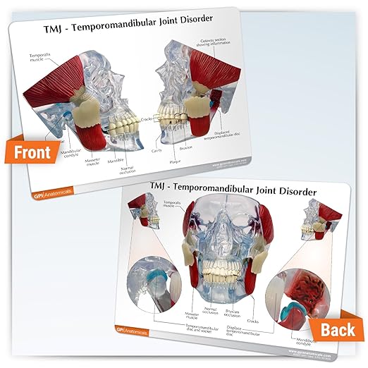 GPI Anatomicals - Temporomandibular Joint (TMJ) Model, Replica with Pathologies for Human Anatomy and Physiology Education, Anatomy Model for Doctor's Offices and Classrooms, Medical Study Supplies