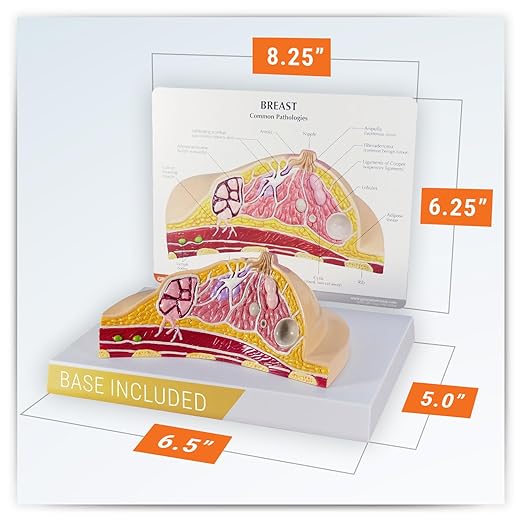 GPI Anatomicals - Breast Cross-Section Model, Replica Showing Common Pathologies for Human Anatomy, Physiology Education, Anatomy Model for Doctor's Offices and Classrooms, Medical Learning Resources