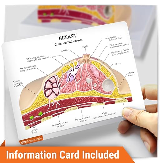 GPI Anatomicals - Breast Cross-Section Model, Replica Showing Common Pathologies for Human Anatomy, Physiology Education, Anatomy Model for Doctor's Offices and Classrooms, Medical Learning Resources