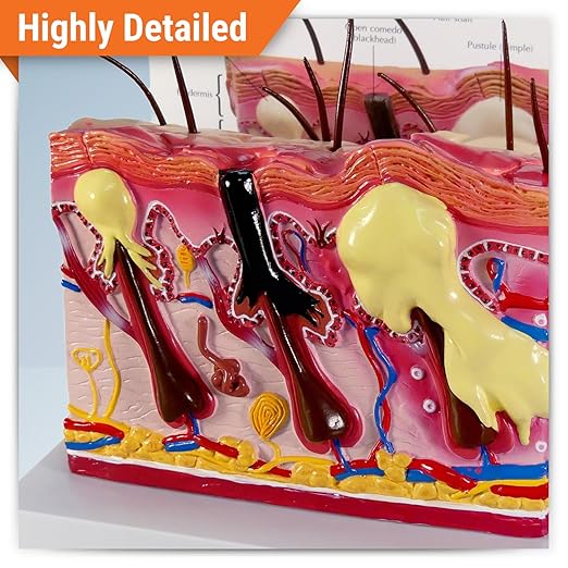 GPI Anatomicals - Skin Acne Model, Cross-Section Showing Normal and Common Acne-Riddled Skin for Human Anatomy, Physiology Education, Anatomy Model for Doctor's Office, Medical Learning Resources